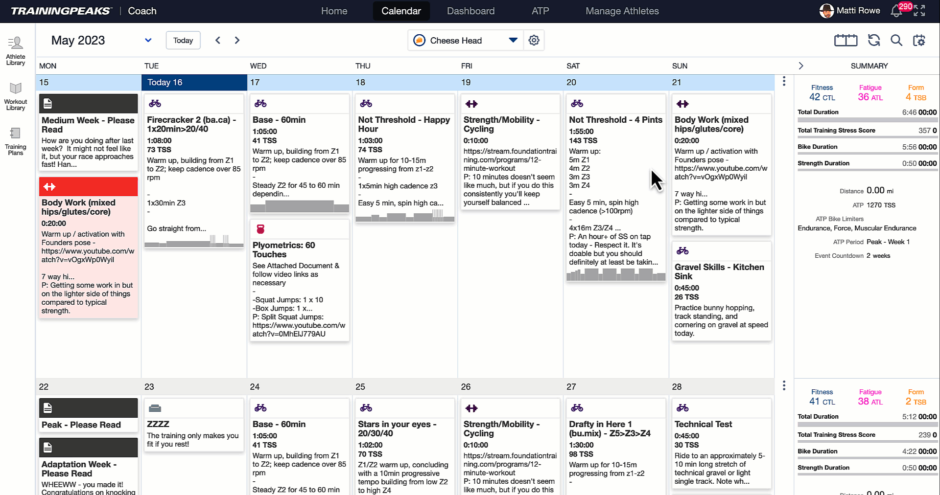 Creating Custom Zones